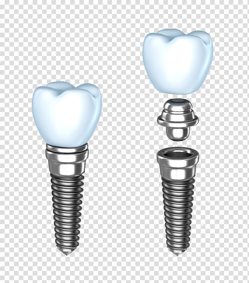 two white tooths, Dental implant Dentistry Dentures Human tooth, Implants transparent background PNG clipart