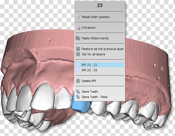 Tooth Clipboard Product Manuals Dentistry Computer Software, dental dental teeth dental model transparent background PNG clipart