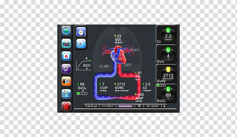 Display device Cardiac output Stroke volume, Physiology transparent background PNG clipart