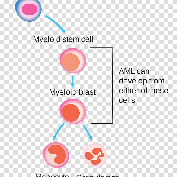 White blood cell Acute myeloid leukemia, blood transparent background