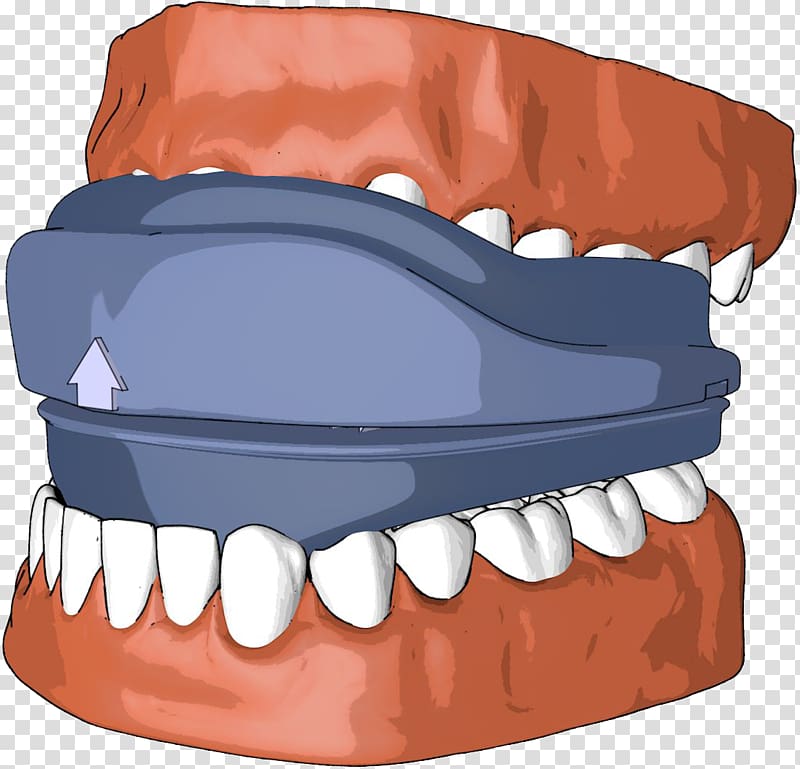 Snoring Sleep apnea Mouthguard Dentistry, snoring transparent background PNG clipart