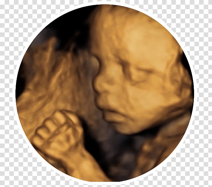 cabinet medical obstetrica-ginecologie dr.serbanoiu Voluson 730 3D ultrasound Ultrasonography 4D-Ultraschall, Leep transparent background PNG clipart