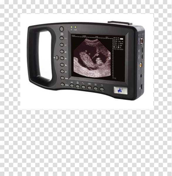 Ultrasound Ultrasonography Medicine Medical diagnosis Doppler echocardiography, ultrasound machine transparent background PNG clipart