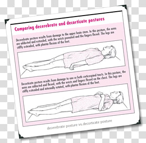 Abnormal posturing Decerebration 除脳硬直 Brain Posture, Brain transparent background PNG clipart thumbnail