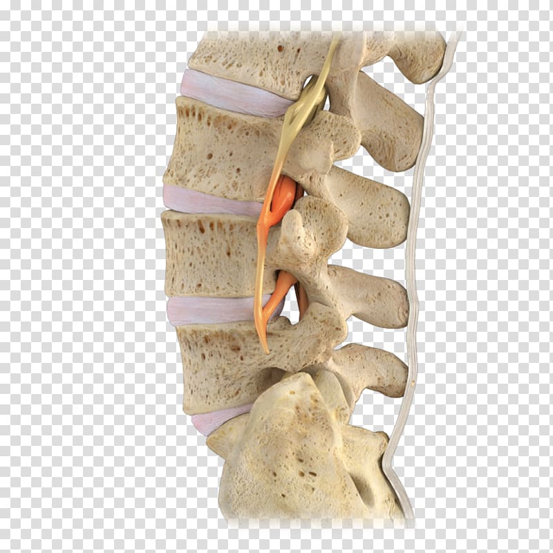 Lumbar vertebrae Vertebral column Spinal stenosis Spinal nerve, others transparent background PNG clipart
