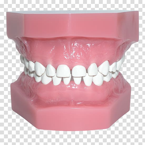 Human tooth Pediatric crowns Occlusion, teeth model transparent background PNG clipart