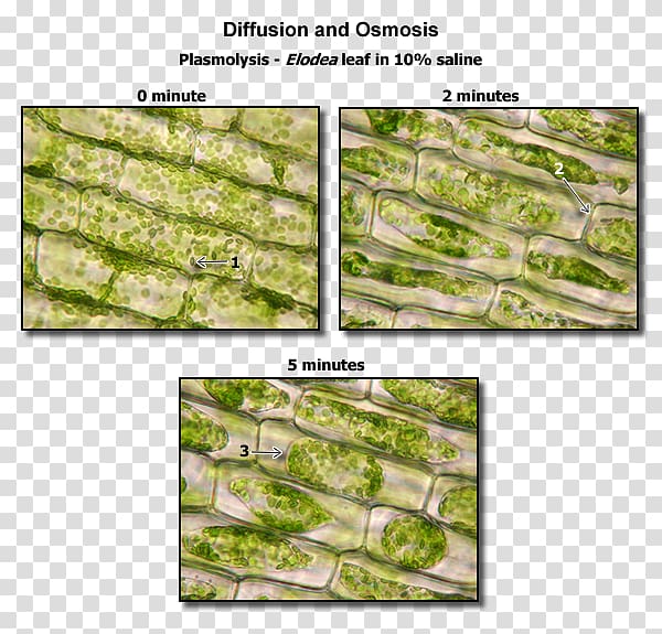 Plasmolysis Plant cell Elodea Biology, body muscle anatomy therapy transparent background PNG clipart