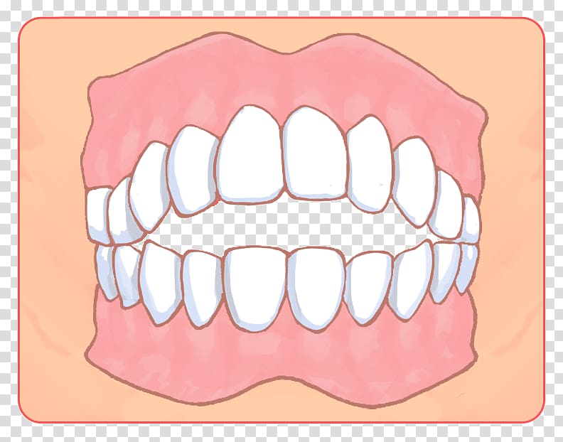 矯正歯科 Dental braces Dentist Dentition Therapy, shin transparent background PNG clipart