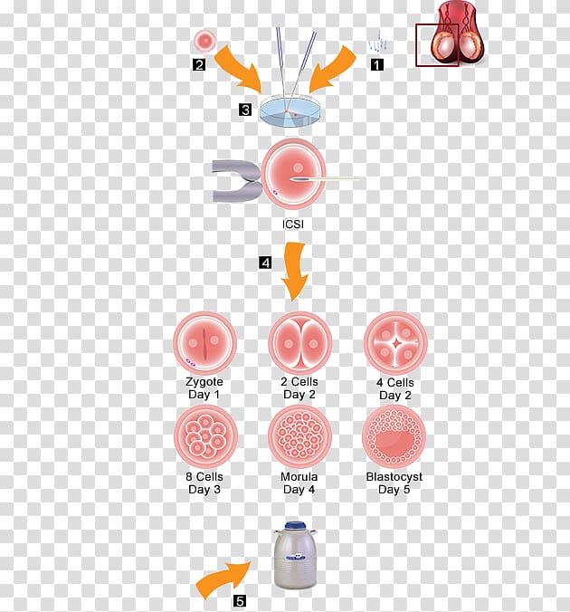 In vitro fertilisation Fertility clinic Intracytoplasmic sperm injection Egg donation, Egg Donation transparent background PNG clipart