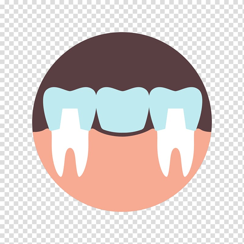 Tooth Midwestern Dental Specialists Prosthodontics Dentistry, crown transparent background PNG clipart