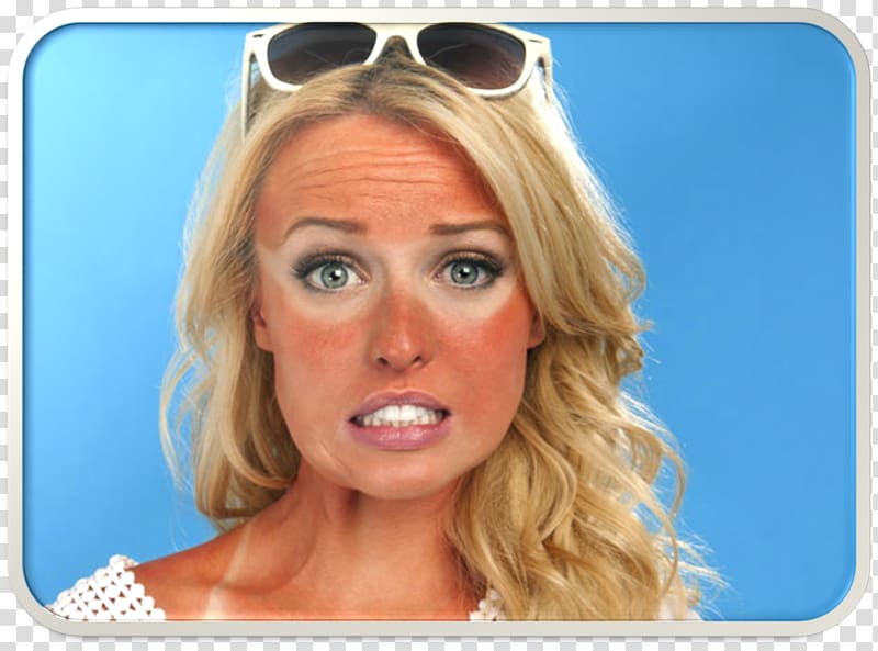 Jorgie Porter Hollyoaks Theresa McQueen Actor, sun burn transparent background PNG clipart