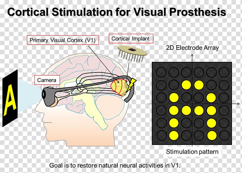 Visual prosthesis Implant Microcoil Technology, Lee Seung Gi transparent background PNG clipart