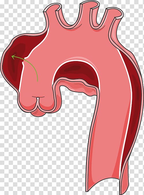 Organ , coronary artery anatomy transparent background PNG clipart