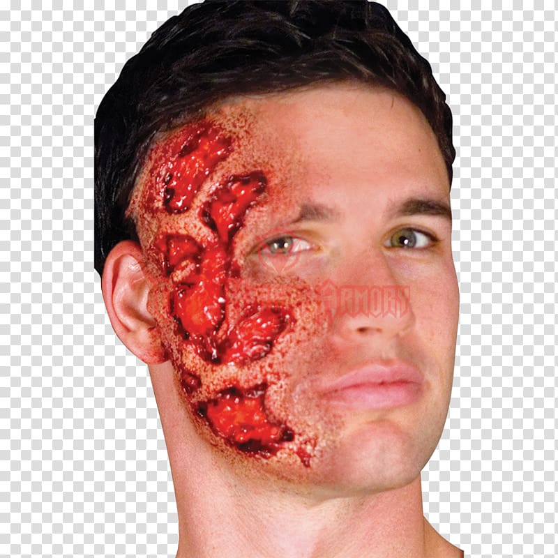 Burn Prosthesis Prosthetic Makeup Wound Scar, burn transparent background PNG clipart