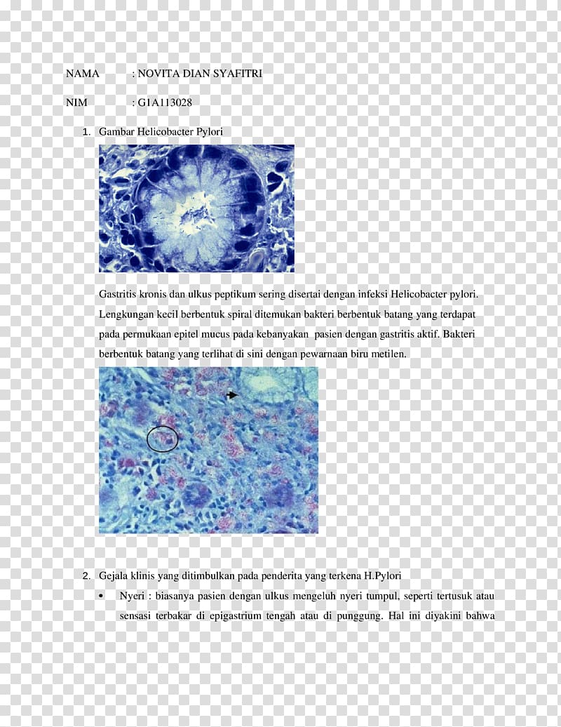 Helicobacter pylori Giemsa stain Organism Brochure, Helicobacter Pylori transparent background PNG clipart