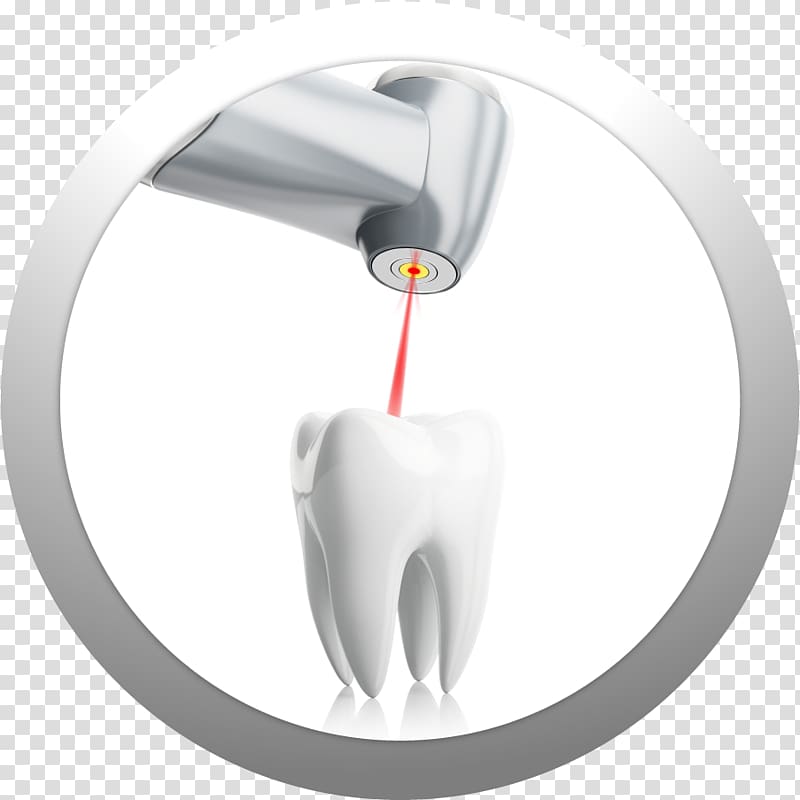 Dental laser Dentistry Tooth, Dental Technology transparent background PNG clipart