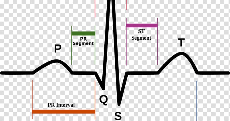 Electrocardiography Heart rate Pulse Diagram, heart transparent background PNG clipart