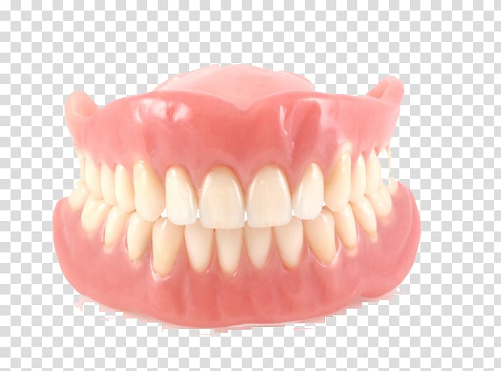 Dentures Removable partial denture Dentistry Dental implant Dental laboratory, crown transparent background PNG clipart