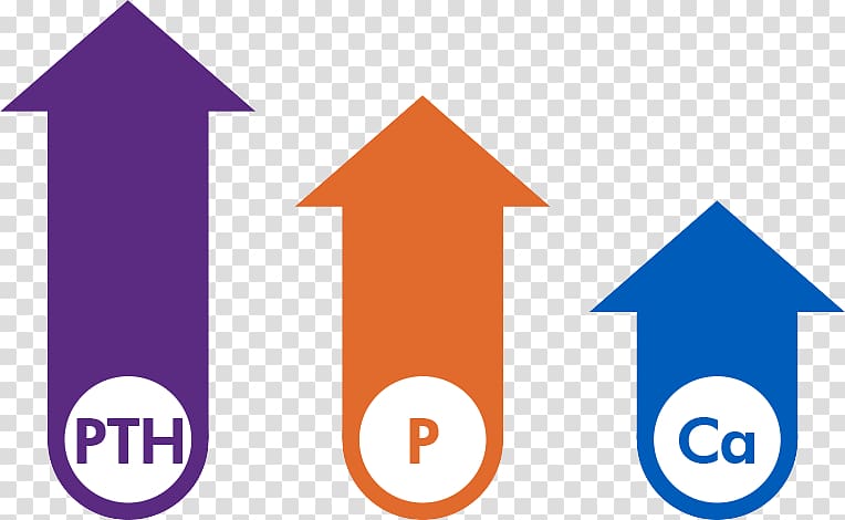 Etelcalcetide Secondary hyperparathyroidism Chronic kidney disease Hemodialysis Parathyroid hormone, others transparent background PNG clipart