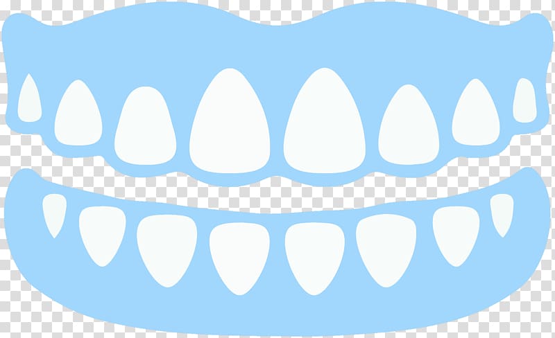 Dentures Dentistry Dental implant Removable partial denture, denture transparent background PNG clipart