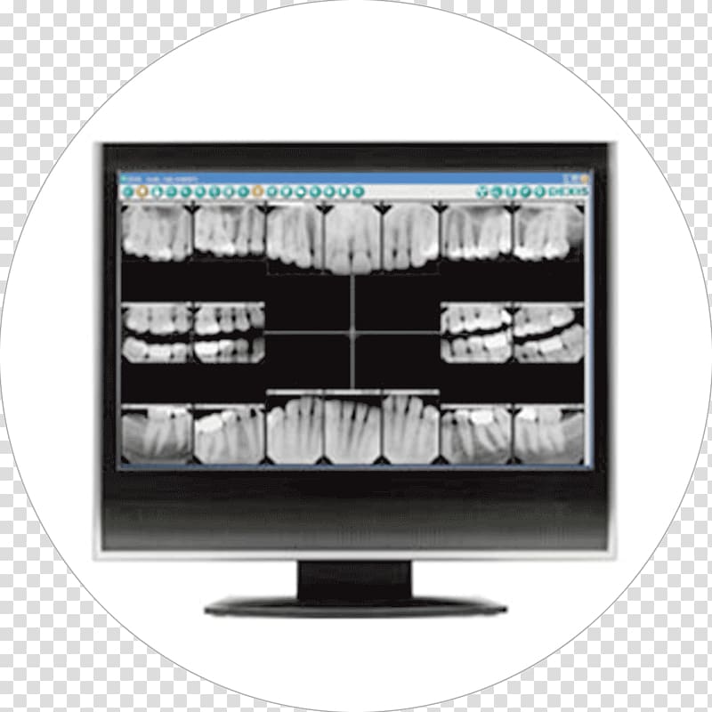 Dentistry Digital radiography Tooth, others transparent background PNG clipart