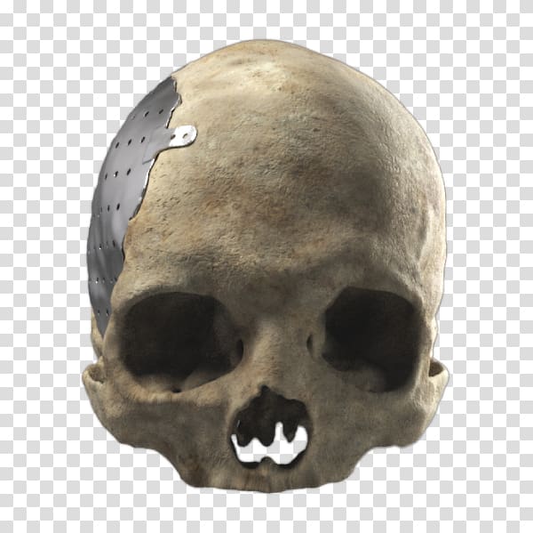 Cranioplasty Poly Skull Snout Skeleton, skull transparent background PNG clipart