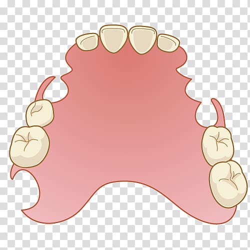 Dentistry Dentures Removable partial denture Mouth, tooth transparent background PNG clipart