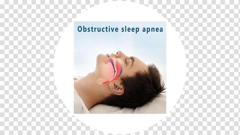 Obstructive Sleep Apnea in Adults, Sleep Apnea transparent background PNG clipart