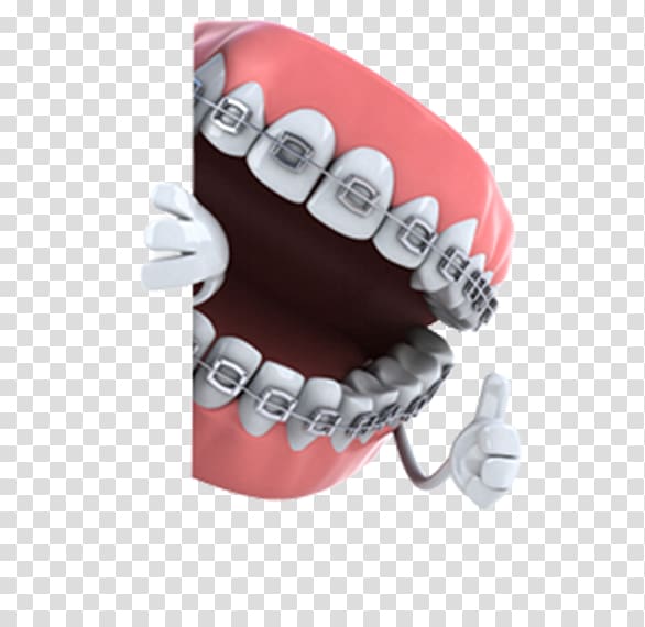 Dentistry Orthodontics Dental braces Tooth Medicine, health transparent background PNG clipart