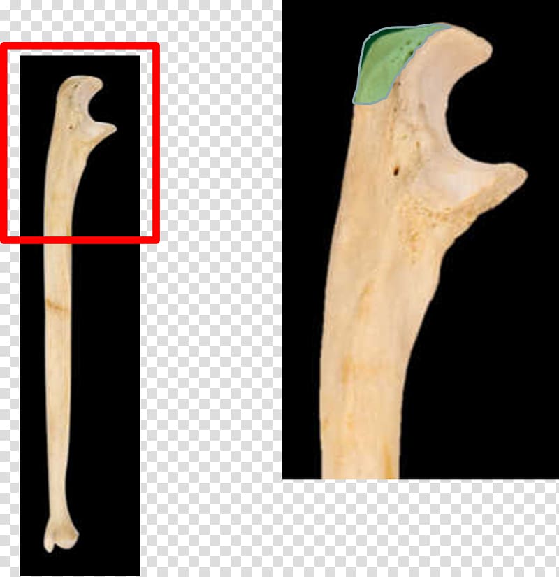 Olecranon Coronoid process of the ulna Ulnar styloid process Trochlear notch, class room transparent background PNG clipart