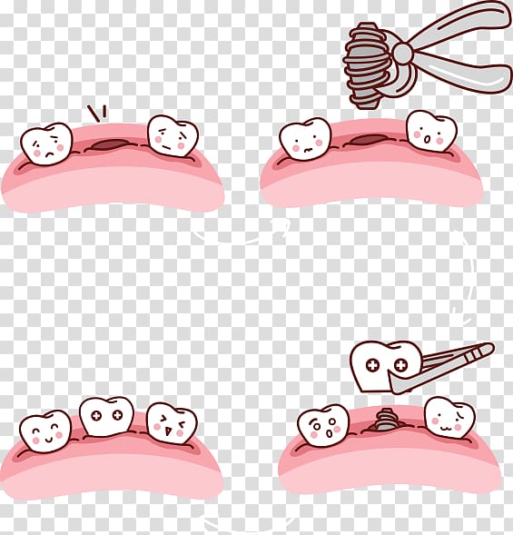 Drawing Tooth Dental implant, Dental Arch transparent background PNG clipart