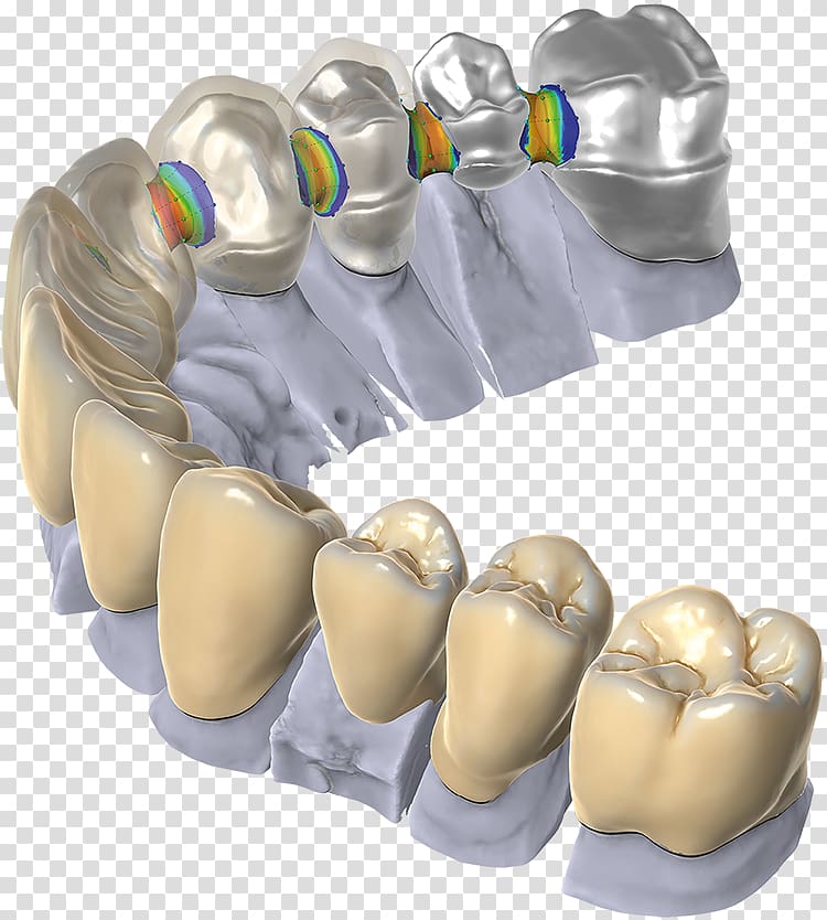 CAD/CAM dentistry Computer-aided design Dental restoration Computer Software, others transparent background PNG clipart
