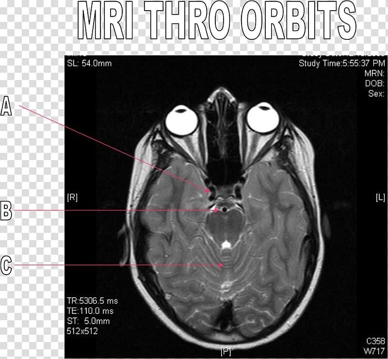 Computed tomography Brain Radiography, Brain transparent background PNG clipart