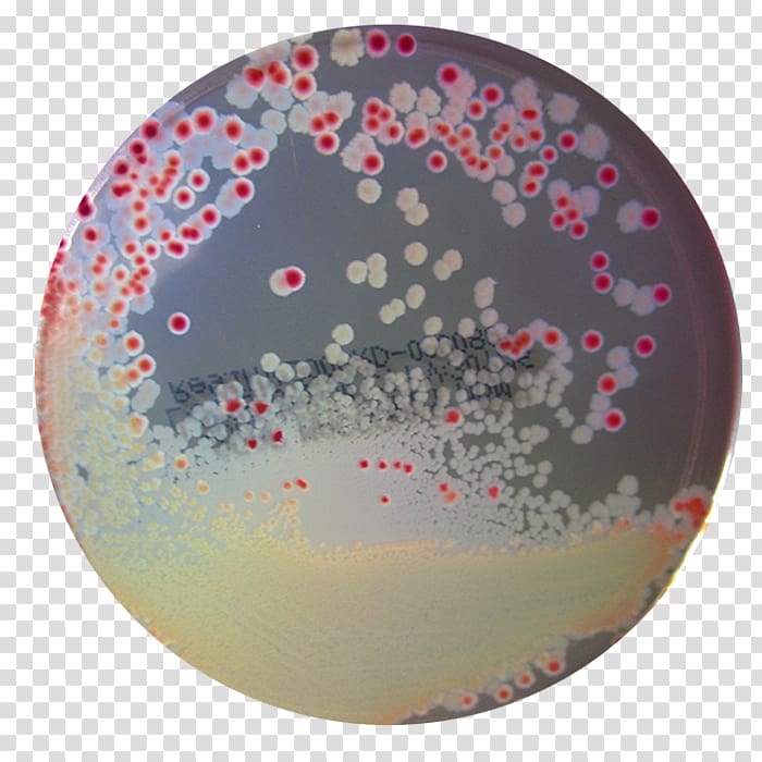 MacConkey agar Bacteria Microbiology Microbiological culture, AGAR AGAR transparent background PNG clipart