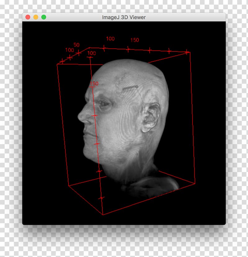 Nose Medical imaging Human behavior Homo sapiens Jaw, nose transparent background PNG clipart