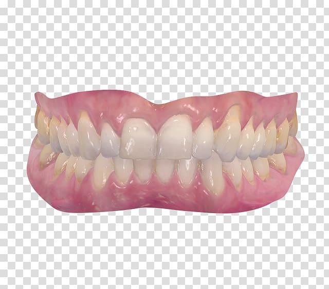 3Shape Dentistry scanner Radiology, Dental Arch transparent background PNG clipart