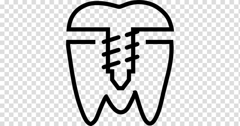 Dentistry Dental implant Dentures All-on-4, health transparent background PNG clipart