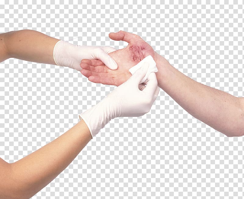 Wound Dressing Arm Bandage Cutting, Dust that cuts the wound transparent background PNG clipart