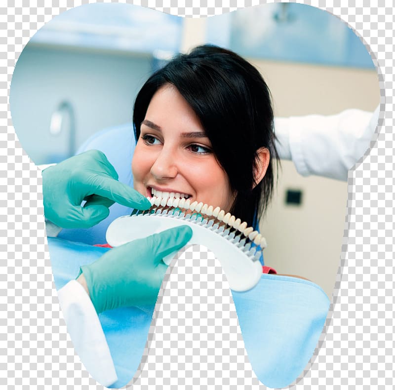 Tooth whitening Dentistry Veneer, others transparent background PNG clipart