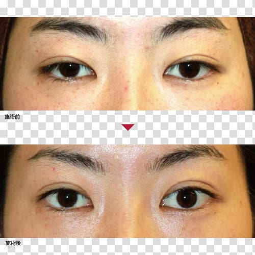 Eyebrow Eyelid Eyelash extensions Primo Azabujuban Clinic, eye case transparent background PNG clipart