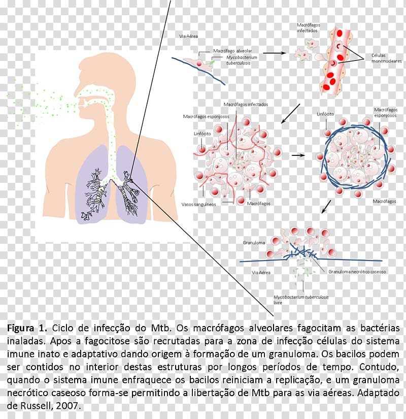 Mycobacterium tuberculosis Pathogenesis Disease Infection, imune transparent background PNG clipart