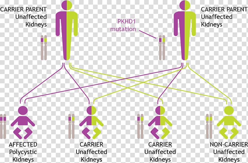 Autosomal recessive polycystic kidney disease Genetic testing Autosomal Dominant Polycystic Kidney Disease Genetics, Polycystic Liver Disease transparent background PNG clipart