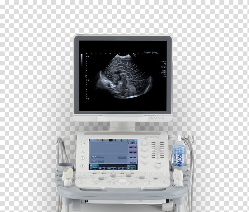 Ultrasound Ultrasonography Medicine Medical diagnosis Surgery, ultrasound transparent background PNG clipart