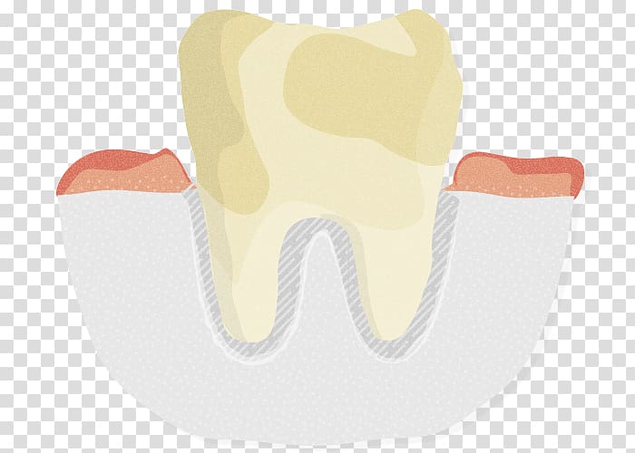 Oral hygiene Tooth Mouth Jaw, gingival bleeding transparent background PNG clipart