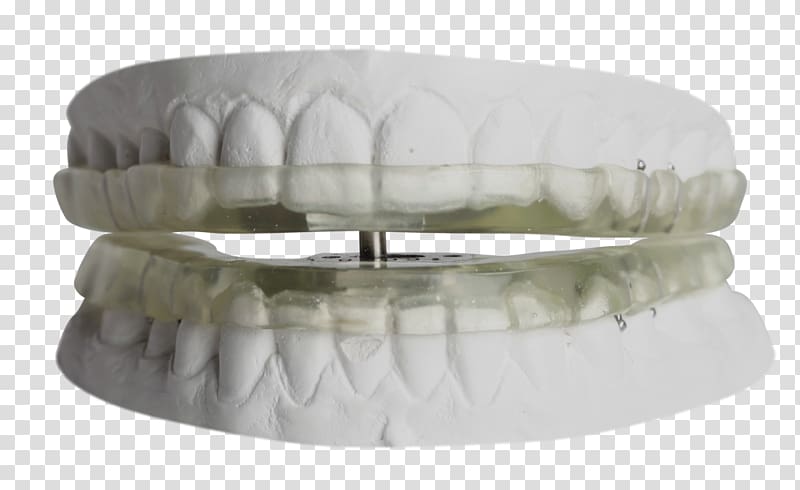 Temporomandibular joint dysfunction Orthodontics Dentistry Mouthguard, others transparent background PNG clipart
