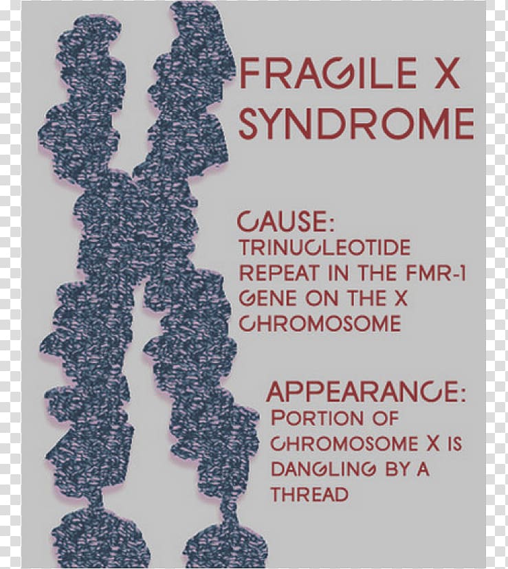 Fragile X syndrome Intellectual disability Genetic disorder 22q13 deletion syndrome, Fragile X Syndrome transparent background PNG clipart