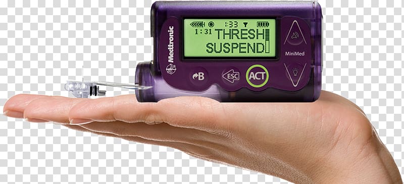 Insulin pump Diabetes mellitus Minimed Paradigm Type 1 diabetes, insulin administration transparent background PNG clipart