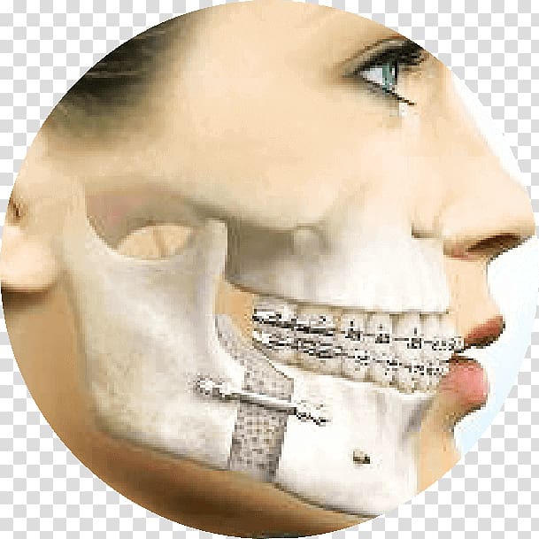 Oral and maxillofacial surgery Orthognathic surgery Jaw Dentist, Face transparent background PNG clipart