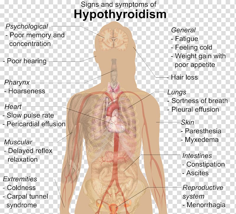 Hypothyroidism Thyroid disease Medical sign Levothyroxine, gingival bleeding transparent background PNG clipart