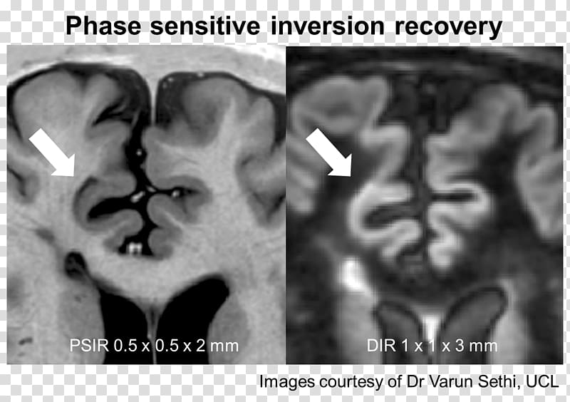 Nose Medical imaging Human behavior Medical radiography Homo sapiens, nose transparent background PNG clipart